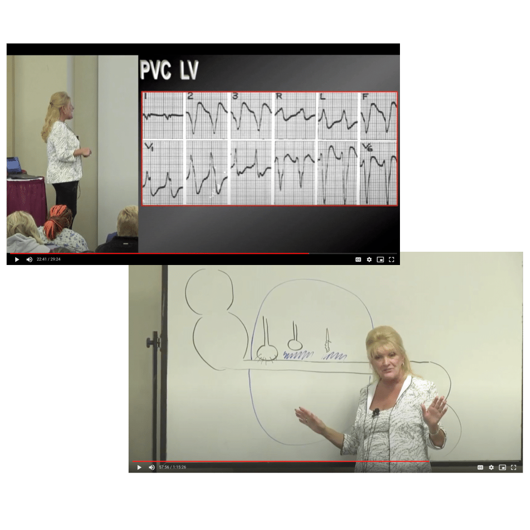 laura gasparis videos